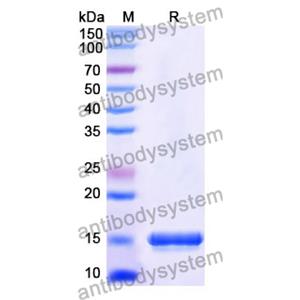 Anti-Human CD120a/TNFRSF1A/TNFR1 Nanobody (SAA1242)