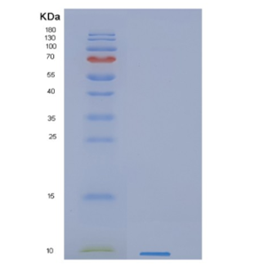 Recombinant Human GYPC Protein,Recombinant Human GYPC Protein