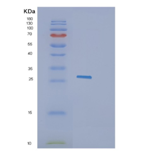 Recombinant Human GZMK Protein,Recombinant Human GZMK Protein