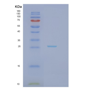 Recombinant Human HAND1 Protein