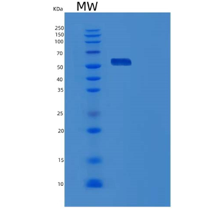 Recombinant Human Harmonin Protein,Recombinant Human Harmonin Protein