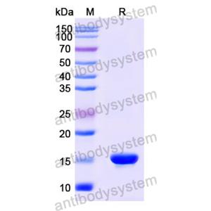 Anti-Human CD66e/CEA/CEACAM5 Nanobody (SAA1298)