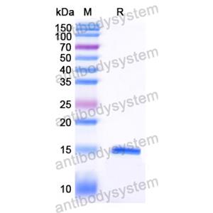 Anti-Human PCSK9 Nanobody (SAA1344)