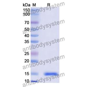 抗 Vibrio cholerae higB-2 納米抗體 (SAA0850)(RXX10101),Anti-Vibrio cholerae higB-2 Nanobody (SAA0850)