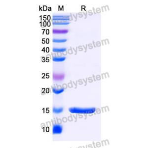 抗 SARS-CoV-2 S Protein 納米抗體 (SAA0986)(RVV00137),Anti-SARS-CoV-2 S Protein Nanobody (SAA0986)