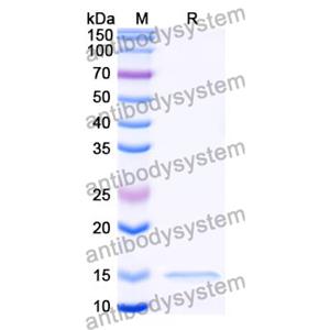 抗 Clostridium botulinum botA/BOTOX 納米抗體 (SAA0932)(RXX00912),Anti-Clostridium botulinum botA/BOTOX Nanobody (SAA0932)