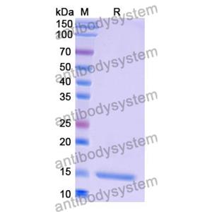 Anti-Human CD184/CXCR4 Nanobody (SAA1262)