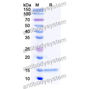 Anti-Human RECQL5 Nanobody (SAA1133)