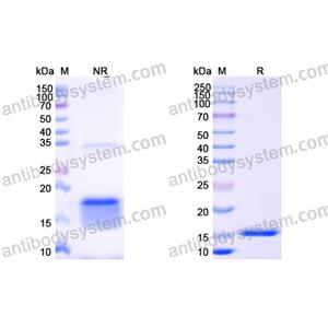 Anti-Human EGFR/ERBB1/HER1 Nanobody (SAA1207)