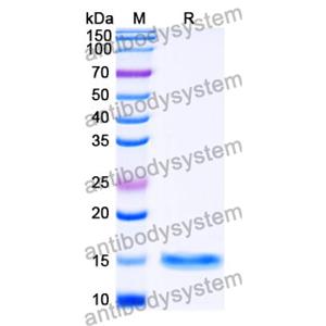 抗 SARS-CoV-2 S Protein 納米抗體 (SAA1094)(RVV00175),Anti-SARS-CoV-2 S Protein Nanobody (SAA1094)