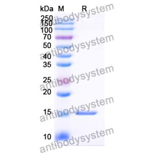 抗 Vibrio cholerae ctxB/Cholera Toxin Subunit B 納米抗體 (A9)(RXX05801),Anti-Vibrio cholerae ctxB/Cholera Toxin Subunit B Nanobody (A9)