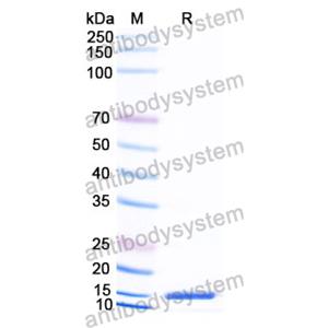 抗 Human RAGE-1/MOK 納米抗體 (SAA1290)(RHJ83001),Anti-Human RAGE-1/MOK Nanobody (SAA1290)