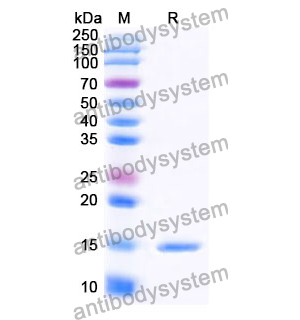 抗 Human SLC10A1 納米抗體 (SAA1145)(RHG93501),Anti-Human SLC10A1 Nanobody (SAA1145)