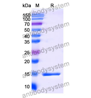 抗 Human CD4 納米抗體 (SAA1296)(RHB95902),Anti-Human CD4 Nanobody (SAA1296)