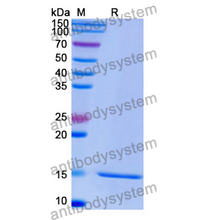 抗 Human GPC3/Glypican 3 納米抗體 (SAA1340)(RHE84601),Anti-Human GPC3/Glypican 3 Nanobody (SAA1340)