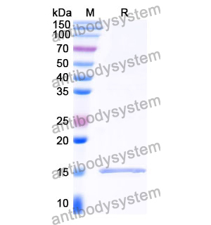 抗 Clostridium botulinum botA/BOTOX 納米抗體 (SAA0934)(RXX00914),Anti-Clostridium botulinum botA/BOTOX Nanobody (SAA0934)