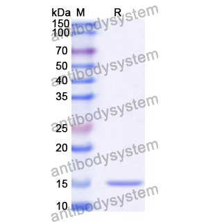 抗 Human MDM4 納米抗體 (SAA1189)(RHA43201),Anti-Human MDM4 Nanobody (SAA1189)