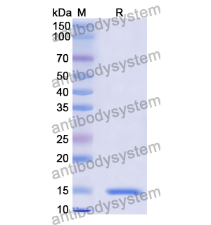 抗 Chick LYZ/Lysozyme C 納米抗體 (SAA0898)(RCK81006),Anti-Chick LYZ/Lysozyme C Nanobody (SAA0898)