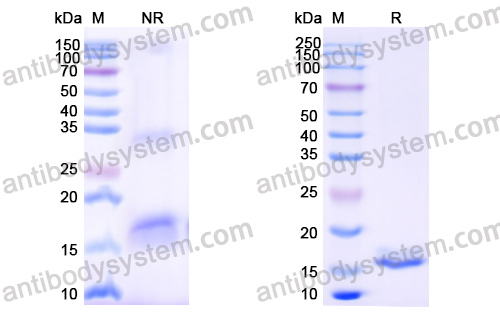 抗 Human EGFR/ERBB1/HER1 納米抗體 (SAA0906)(RHB86902),Anti-Human EGFR/ERBB1/HER1 Nanobody (SAA0906)