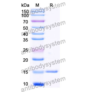 抗 Wild turkey LYZ/Lysozyme C 纳米抗体 (SAA0888)(RCK81003),Anti-Wild turkey LYZ/Lysozyme C Nanobody (SAA0888)