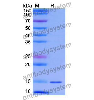 抗 Human CDH17/Cadherin-17 納米抗體 (SAA1325)(RHG31402),Anti-Human CDH17/Cadherin-17 Nanobody (SAA1325)