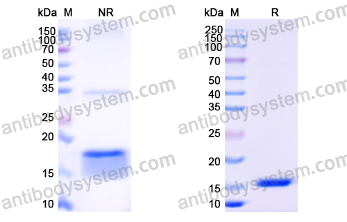 抗 Human EGFR/ERBB1/HER1 納米抗體 (SAA1292)(RHB86906),Anti-Human EGFR/ERBB1/HER1 Nanobody (SAA1292)