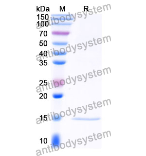 抗 Clostridium botulinum botA/BOTOX 纳米抗体 (SAA0935)(RXX00915),Anti-Clostridium botulinum botA/BOTOX Nanobody (SAA0935)