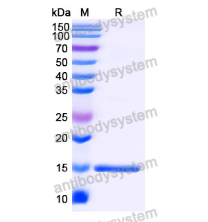 抗 SARS-CoV-2 S Protein 納米抗體 (SAA0974)(RVV00136),Anti-SARS-CoV-2 S Protein Nanobody (SAA0974)