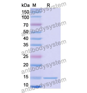 抗 Human VEGFA 纳米抗体 (SAA1168)(RHD12604),Anti-Human VEGFA Nanobody (SAA1168)