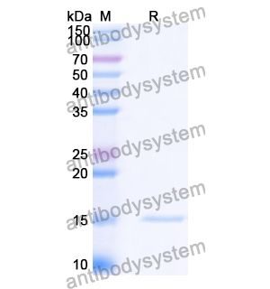 抗 Vibrio cholerae higB-2 納米抗體 (SAA0852)(RXX10103),Anti-Vibrio cholerae higB-2 Nanobody (SAA0852)