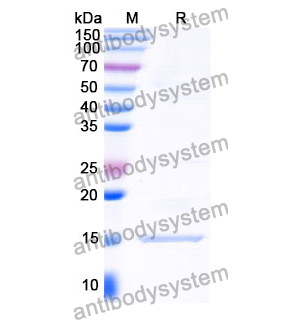 抗 Clostridium botulinum botA/BOTOX 納米抗體 (SAA0923)(RXX00903),Anti-Clostridium botulinum botA/BOTOX Nanobody (SAA0923)