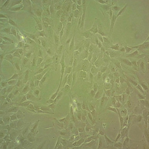 海馬神經(jīng)元細(xì)胞系,Hippocampal neuron cell line