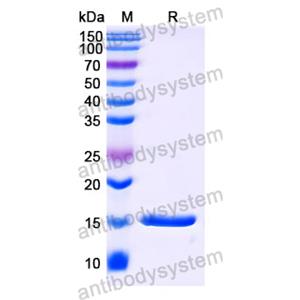 抗 Human FURIN 納米抗體 (SAA1180)(RHC44601),Anti-Human FURIN Nanobody (SAA1180)