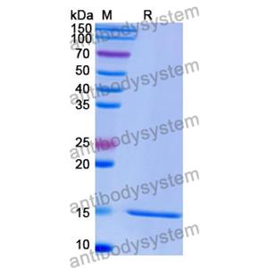 抗 Human GPC3/Glypican 3 納米抗體 (SAA1340)(RHE84601),Anti-Human GPC3/Glypican 3 Nanobody (SAA1340)