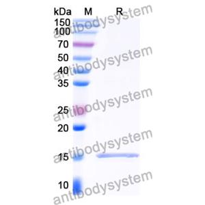 抗 Clostridium botulinum botA/BOTOX 納米抗體 (SAA0934)(RXX00914),Anti-Clostridium botulinum botA/BOTOX Nanobody (SAA0934)