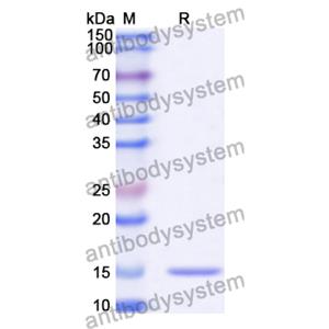 抗 Human MDM4 納米抗體 (SAA1189)(RHA43201),Anti-Human MDM4 Nanobody (SAA1189)