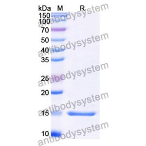 Anti-Clostridium botulinum botA/BOTOX Nanobody (SAA0922)