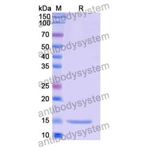 抗 Human LYZ 纳米抗体 (SAA1157)(RHF45701),Anti-Human LYZ Nanobody (SAA1157)