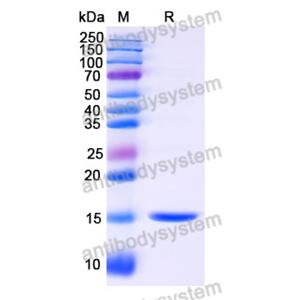 Anti-Human ANGPT4 Nanobody (SAA1257)