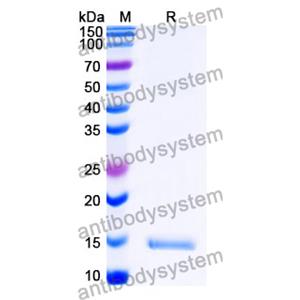 抗 SARS-CoV-2 S Protein 納米抗體 (SAA1121)(RVV00189),Anti-SARS-CoV-2 S Protein Nanobody (SAA1121)