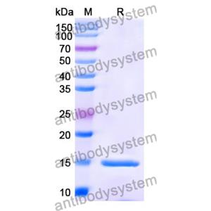 抗 Human APP 納米抗體 (SAA1209)(RHC12501),Anti-Human APP Nanobody (SAA1209)