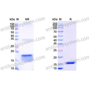 Anti-Human EGFR/ERBB1/HER1 Nanobody (SAA1292)