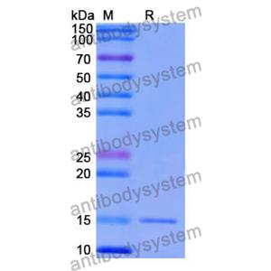 Anti-Human PTH1R Nanobody (SAA1275)