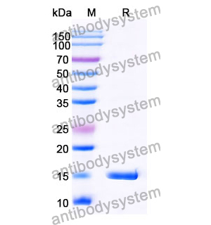 抗 Human TK1 納米抗體 (SAA1373)(RHC07401),Anti-Human TK1 Nanobody (SAA1373)