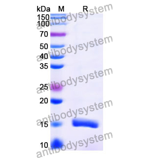 抗 Vibrio cholerae serotype O1 higB-2 納米抗體 (SAA1029)(RXX10105),Anti-Vibrio cholerae serotype O1 higB-2 Nanobody (SAA1029)