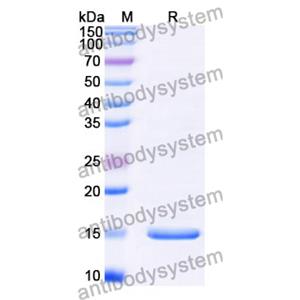 Anti-Clostridium botulinum botA/BOTOX Nanobody (SAA0927)