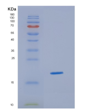 Recombinant Human HBA2 Protein,Recombinant Human HBA2 Protein