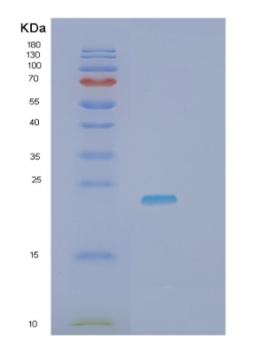 Recombinant Human HAVCR2 Protein,Recombinant Human HAVCR2 Protein