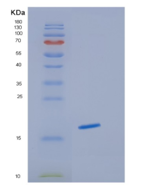 Recombinant Human HBG1 Protein,Recombinant Human HBG1 Protein