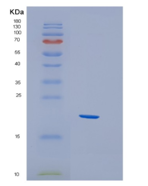 Recombinant Human HBXIP Protein,Recombinant Human HBXIP Protein